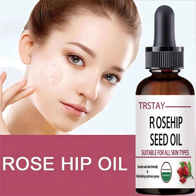 5ML/15ML/30ML/50ML/Pure Essential Oils Rosehip Oil Moisturizing Brighten Skin